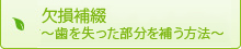 欠損補綴 ～歯を失った部分を補う方法～